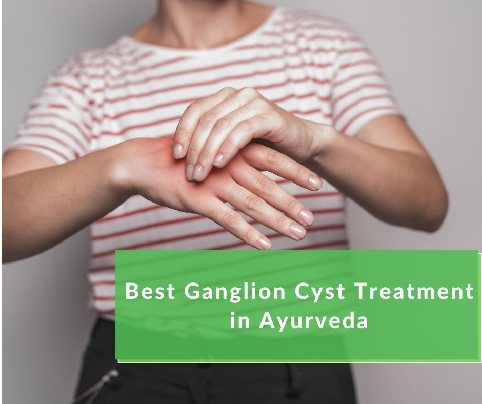 Read more about the article Best Ganglion Cyst Treatment in Ayurveda